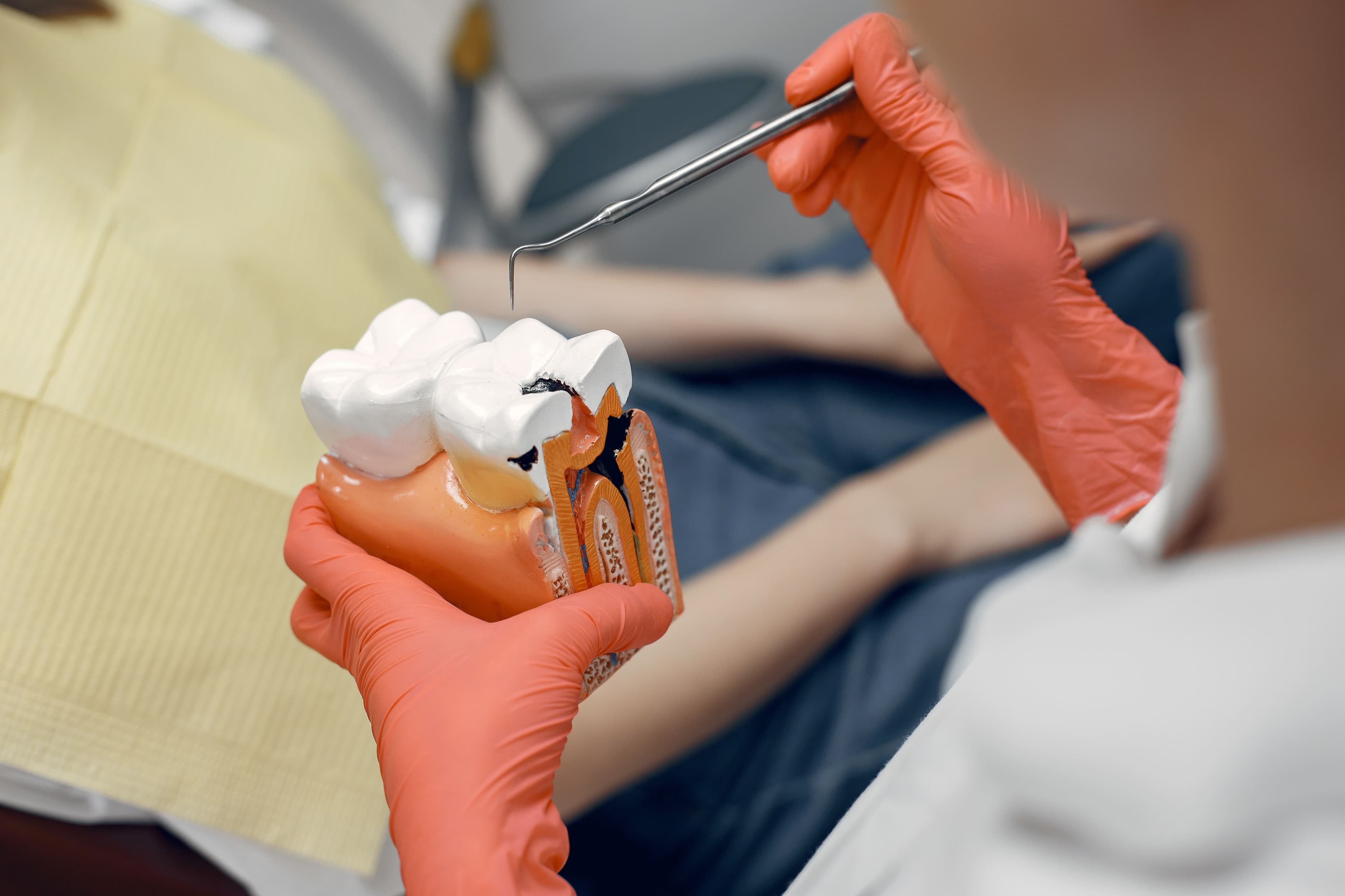 Endodontia (Tratamento de Canal)