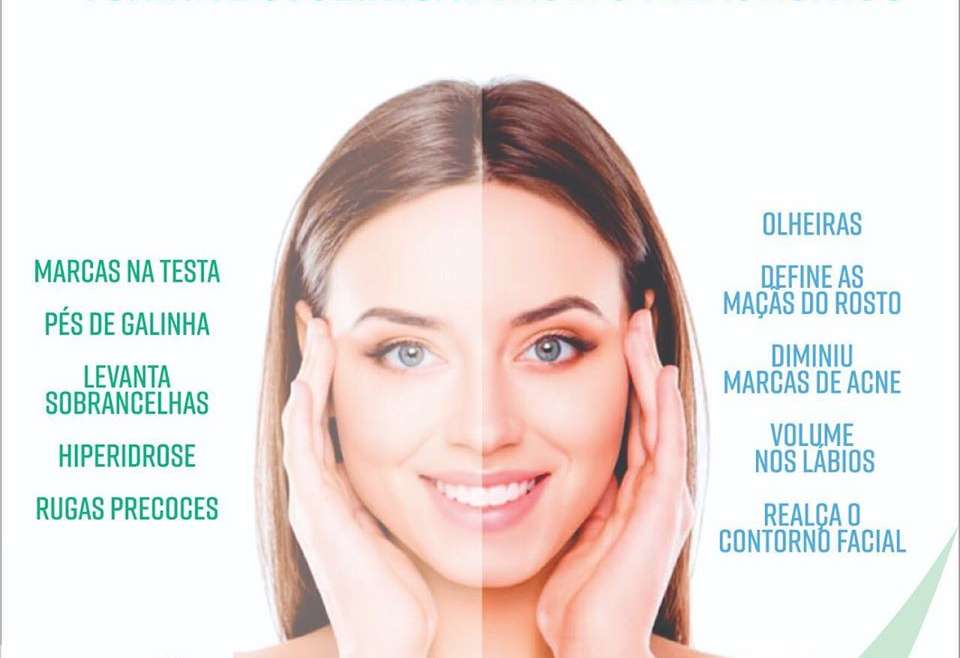 Toxina Botulínica ou Ácido Hialurônico?
